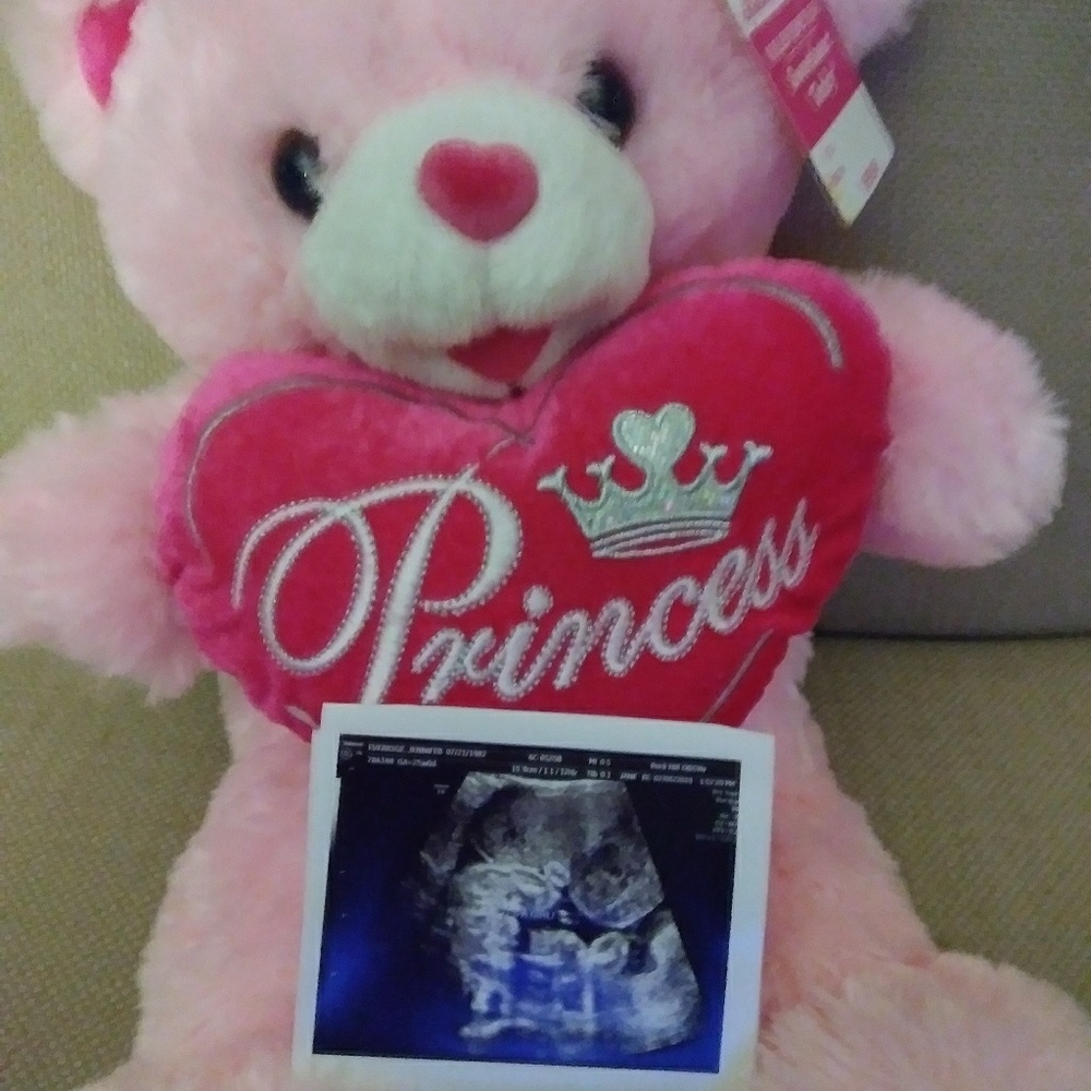 Its a girl!!!!! :)